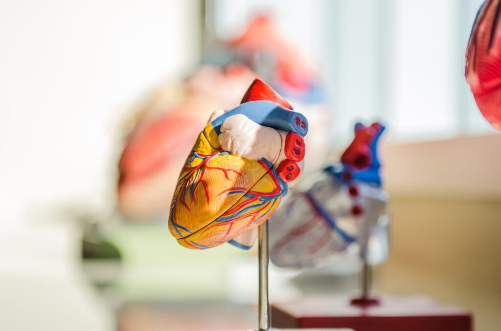 Myocardial Infarction Heart