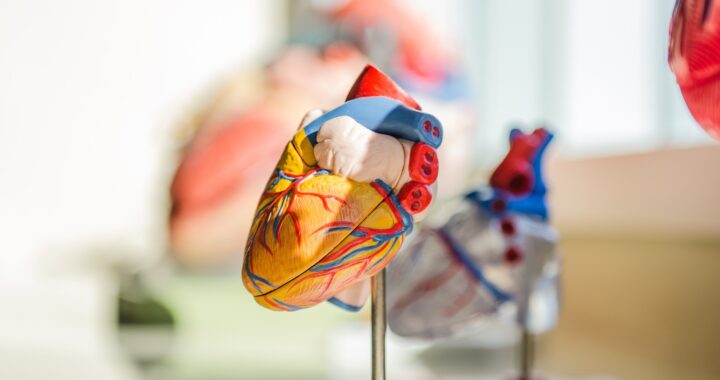 Myocardial Infarction Heart