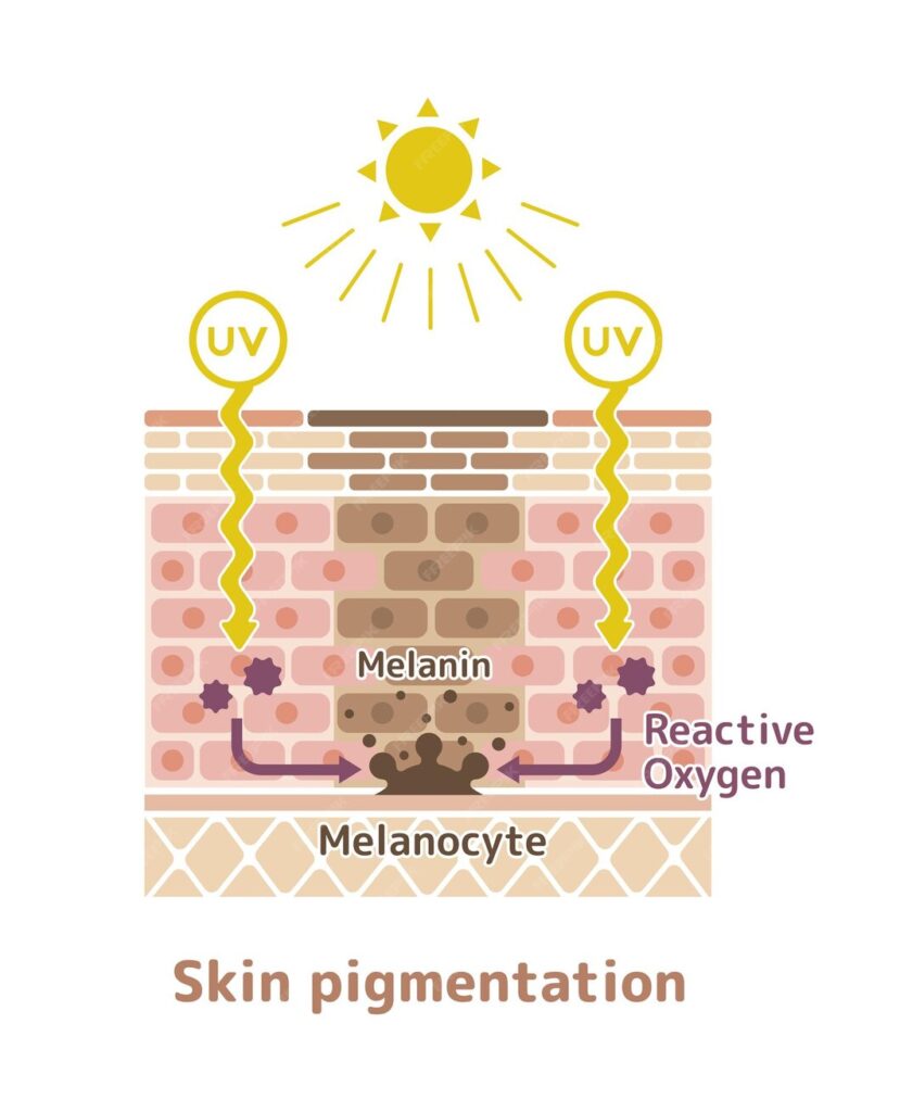 Vitiligo - Melanin pigment production in skin - Modern HealthMe 