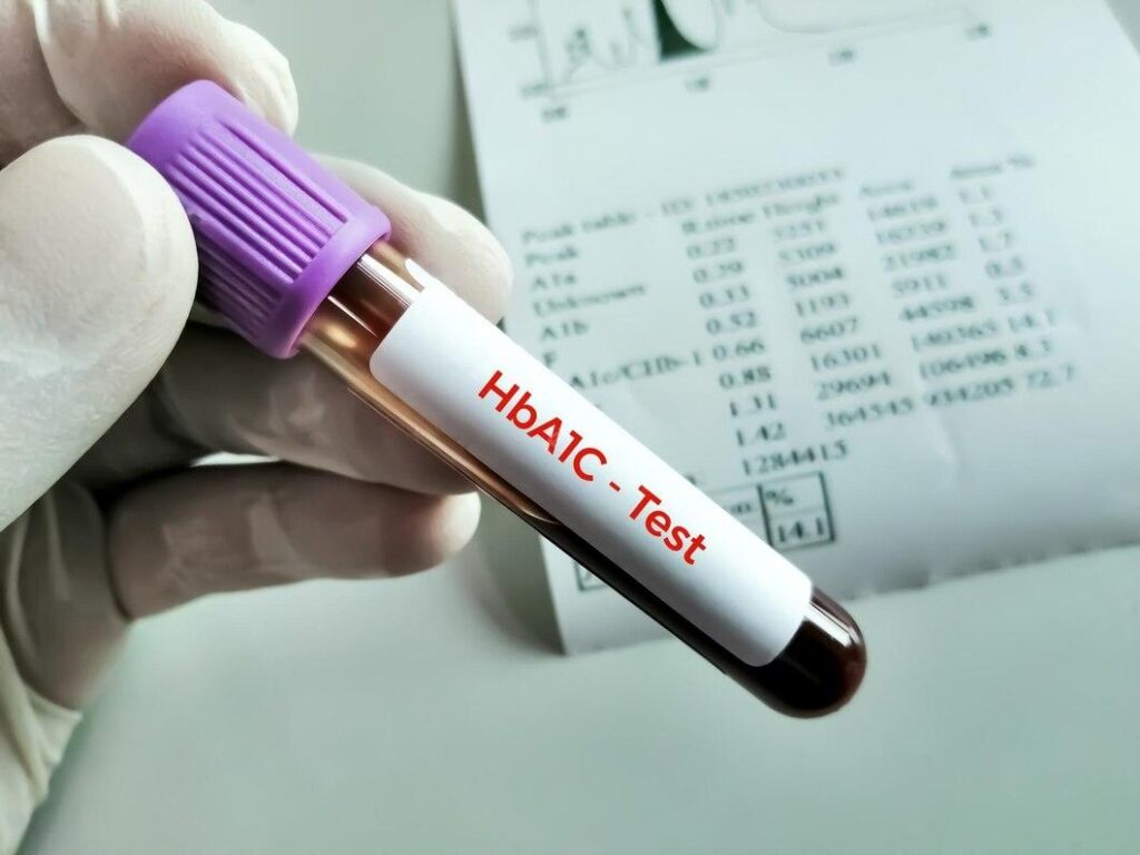 HbA1c Test - Modern HealthMe - Modern Health me 