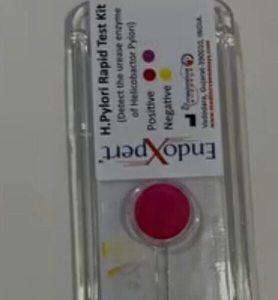 Rapid Urease Test (RUT) for Helicobacter pylori: Principle, Procedure, and Clinical Significance
